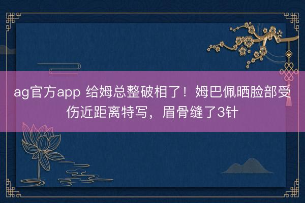 ag官方app 给姆总整破相了！姆巴佩晒脸部受伤近距离特写，眉骨缝了3针
